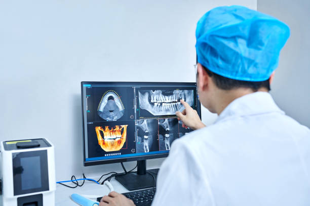 Best Knocked-Out Tooth (Avulsed Tooth) Treatment in White Oak, MD