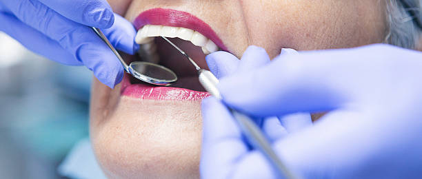 Best Emergency Denture Repair in White Oak, MD